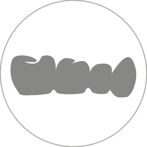 Krone und Brücke aus CoCr